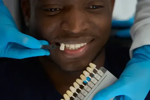 doctor selecting veneers