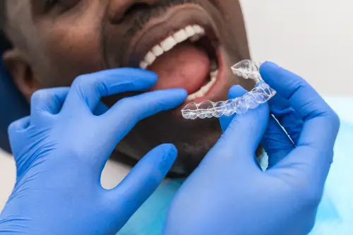 close up of a dental hygienist fitting a retainer