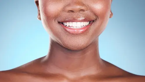 woman teeth and smile