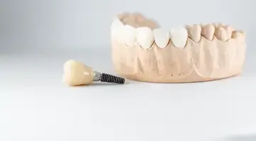Model of an artificial jaw with a dental implant