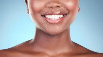 Woman with a healthy smile after smile design treatment